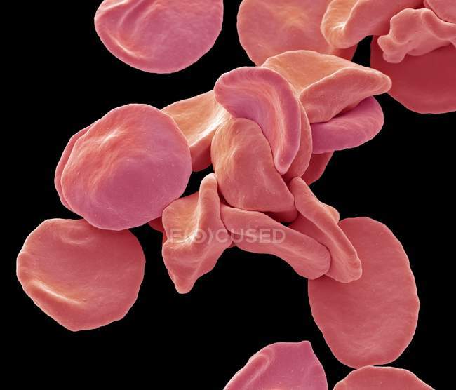 Micrographie électronique à balayage coloré des globules rouges
. — Photo de stock