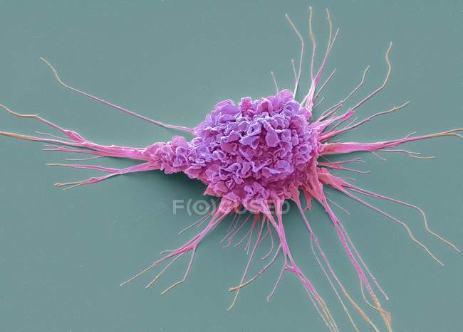 Micrógrafo electrónico de barrido coloreado de la célula dendrítica protectora del sistema inmune . - foto de stock
