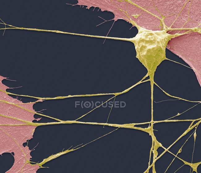 Micrographie électronique à balayage coloré de cellules de neurones moteurs dérivées de cellules souches . — Photo de stock