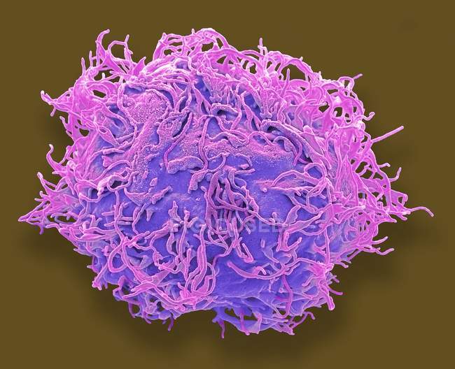 Farbige Rasterelektronenmikroskopie menschlicher mesenchymaler Stammzellen. — Stockfoto