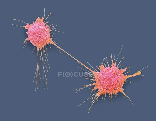 Dividing prostate cancer cells, coloured scanning electron micrograph. — Stock Photo