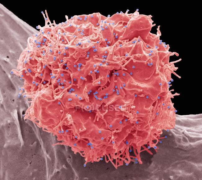 Coloured scanning electron micrograph of 293T cell infected with human immunodeficiency virus. — Stock Photo