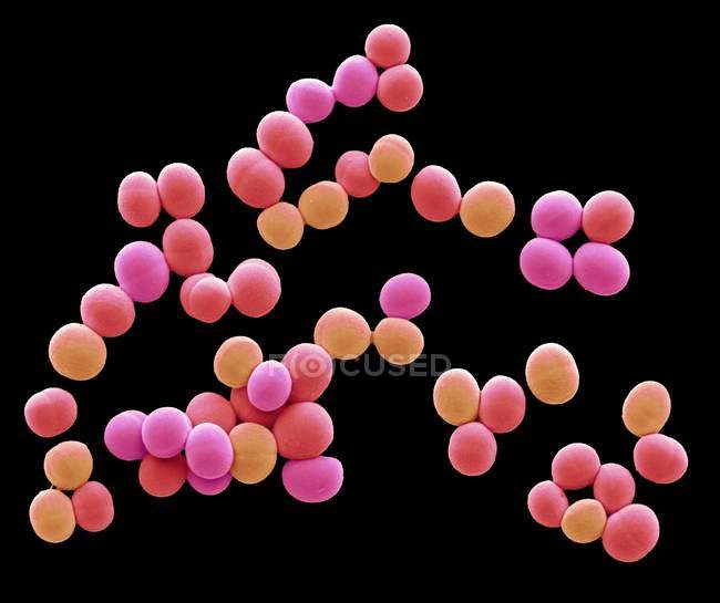 Micrógrafo electrónico de barrido coloreado de bacterias Staphylococcus aureus . - foto de stock