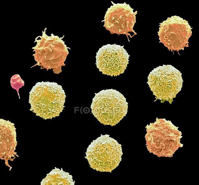 Colored scanning electron micrograph of white blood cells and single platelet. — Stock Photo