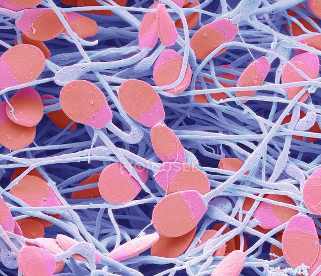 Colored scanning electron micrograph of immature pig sperm from epididymis. — Stock Photo