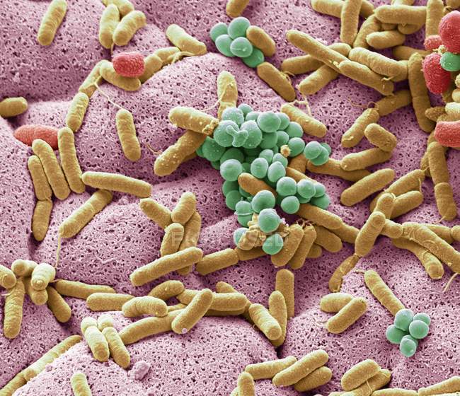 Цветной сканирующий электронный микрограф бактерий, культивируемых из используемой посуды . — стоковое фото