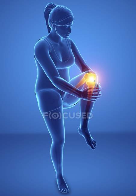 Silueta femenina con dolor de rodilla, ilustración digital . - foto de stock