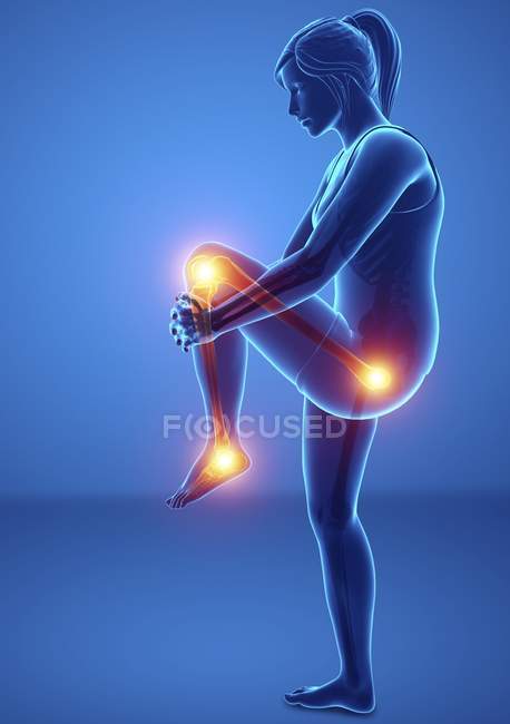 Женский силуэт с болью в ногах, цифровая иллюстрация
. — стоковое фото