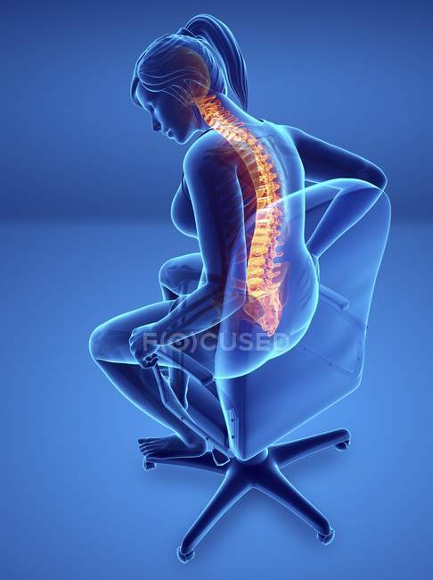 Sitzen im Stuhl weibliche Silhouette mit Rückenschmerzen, digitale Illustration. — Stockfoto