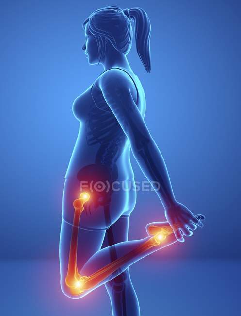 Silueta femenina con dolor en las piernas, ilustración digital . - foto de stock