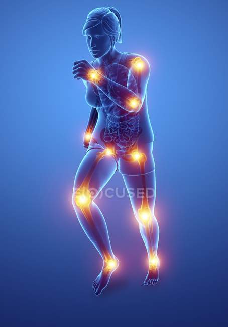 Running female silhouette with joint pain, digital illustration. — Stock Photo