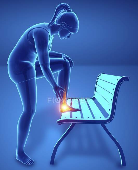 Bending on bench female silhouette with foot pain, digital illustration. — Stock Photo