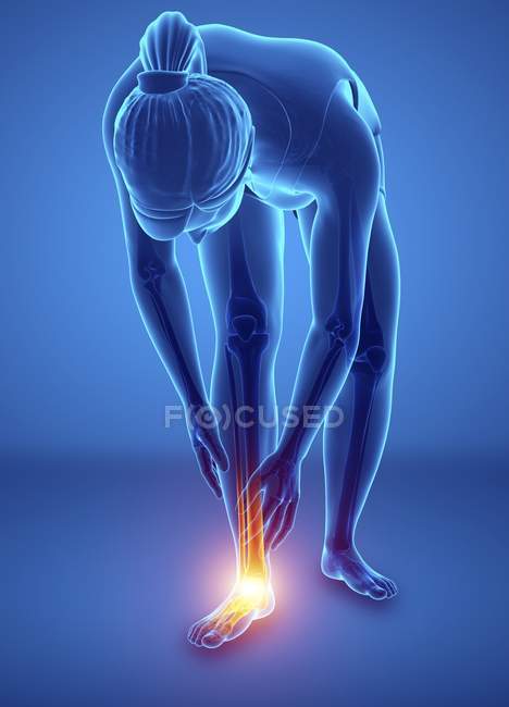 Flexión silueta femenina con dolor en el pie, ilustración digital . - foto de stock