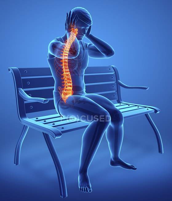 Sitzen auf Bank weibliche Silhouette mit Rückenschmerzen, digitale Illustration. — Stockfoto