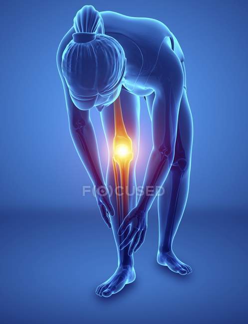 Bending female silhouette with knee pain, digital illustration. — Stock Photo
