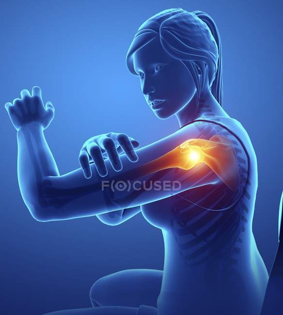Silueta femenina con dolor de hombro, ilustración digital
. - foto de stock