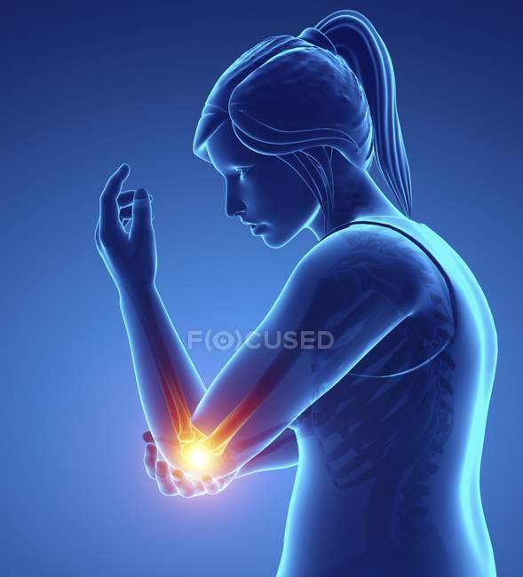 Silhueta feminina com dor no cotovelo, ilustração digital . — Fotografia de Stock