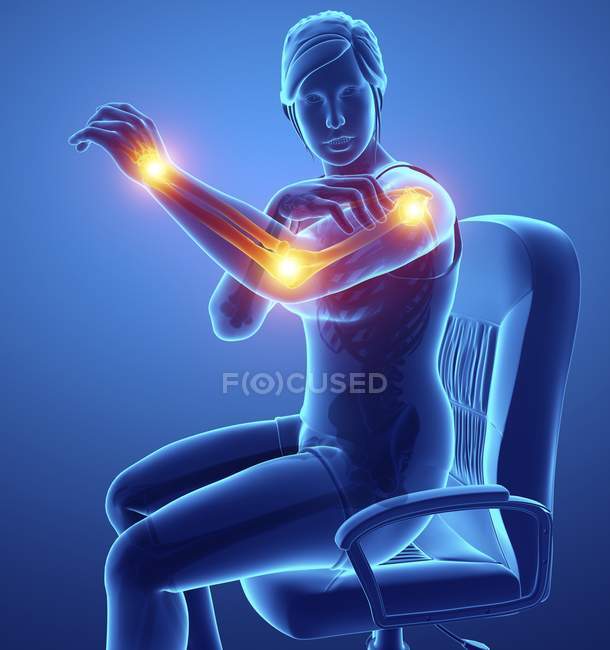 Seduto in sedia silhouette femminile con dolore al braccio, illustrazione digitale . — Foto stock