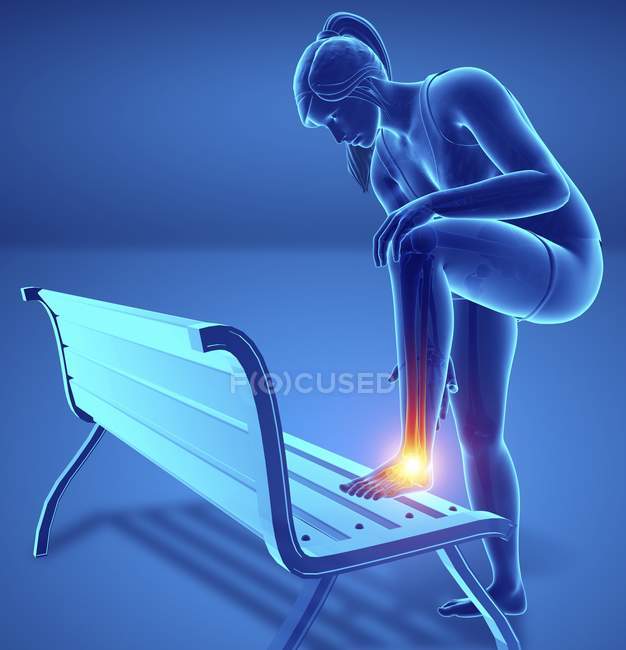 Pliage sur banc silhouette féminine avec douleur au pied, illustration numérique . — Photo de stock