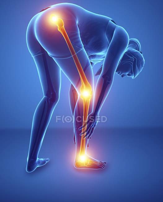 Bending female silhouette with leg pain, digital illustration. — Stock Photo
