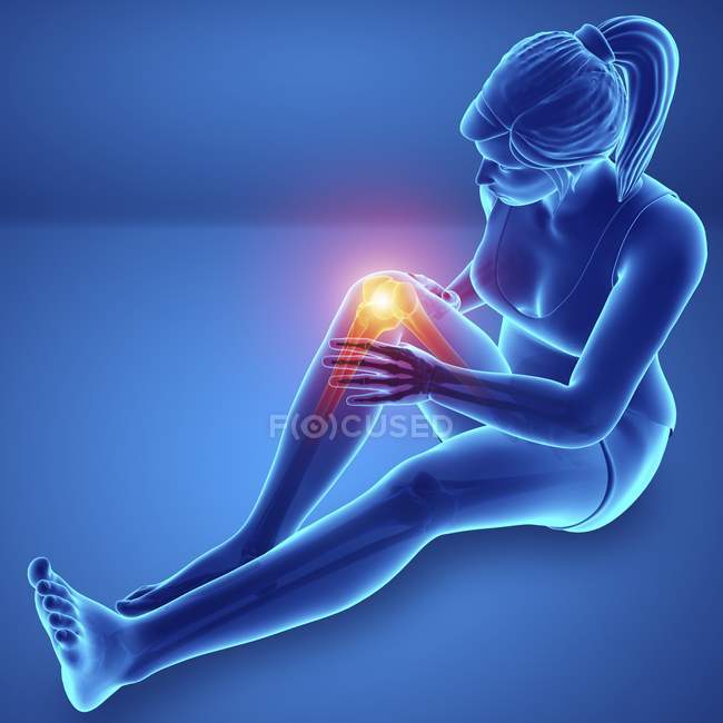Sitzende weibliche Silhouette mit Knieschmerzen, digitale Illustration. — Stockfoto