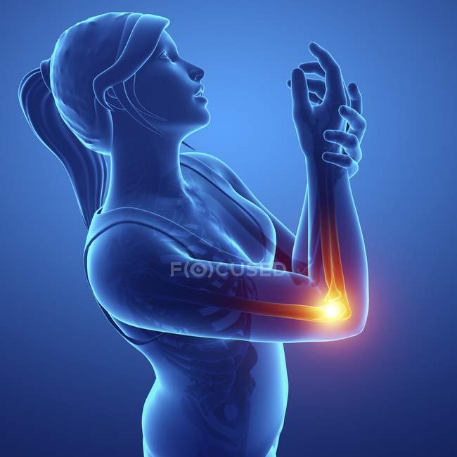 Silhouette féminine avec douleur au poignet, illustration numérique . — Photo de stock