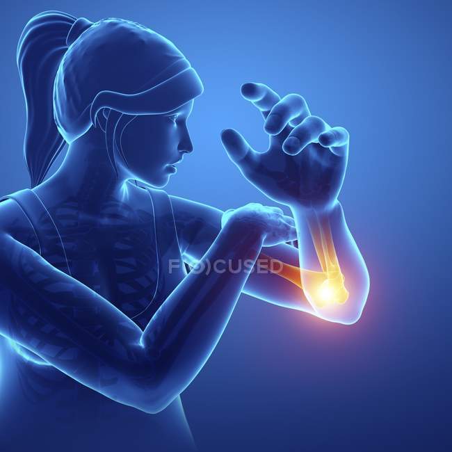 Female silhouette with elbow pain, digital illustration. — Stock Photo