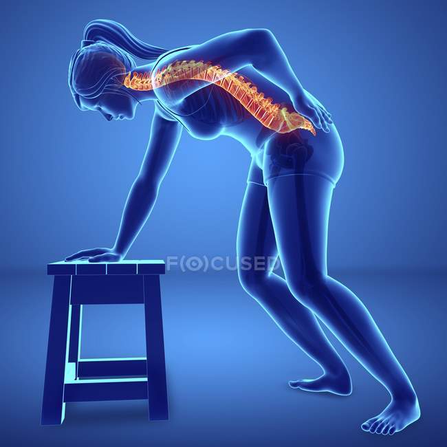 Flexión silueta femenina con dolor de espalda, ilustración digital . - foto de stock