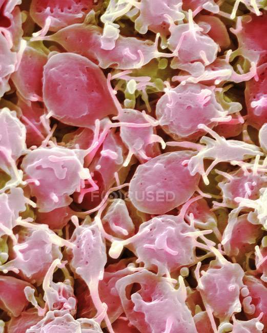 Неактивированные фрагменты клеток крови, тромбоциты, цветной сканирующий электронный микрограф
. — стоковое фото