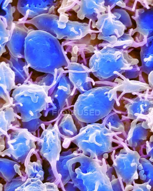 Активовані фрагменти тромбоцитів кров'яних клітин, кольоровий скануючий електронний мікрограф . — стокове фото
