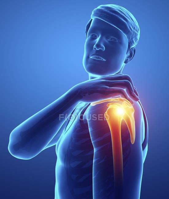 Male silhouette with shoulder pain, digital illustration. — Stock Photo