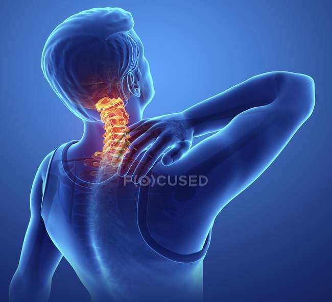 Male silhouette with back pain, digital illustration. — Stock Photo
