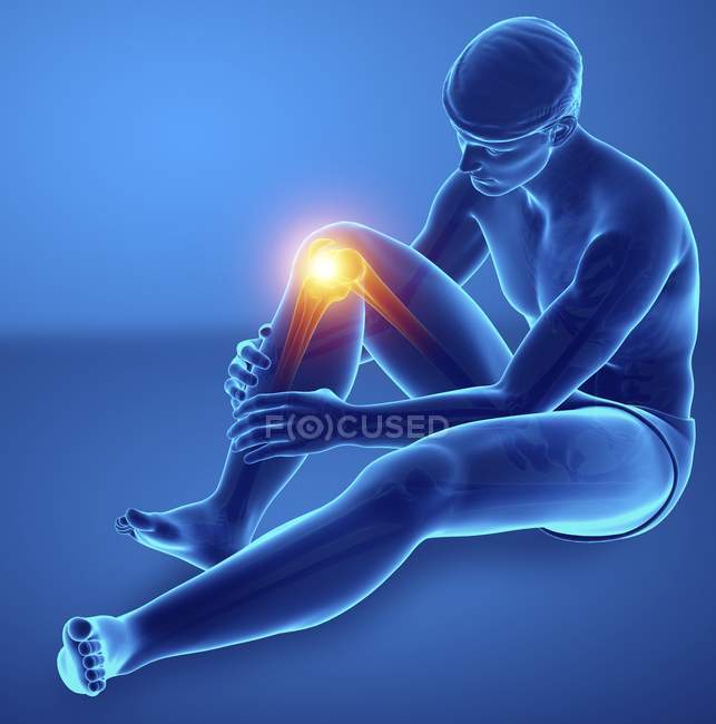Чоловічий силует з коліном біль, цифрова ілюстрація. — стокове фото