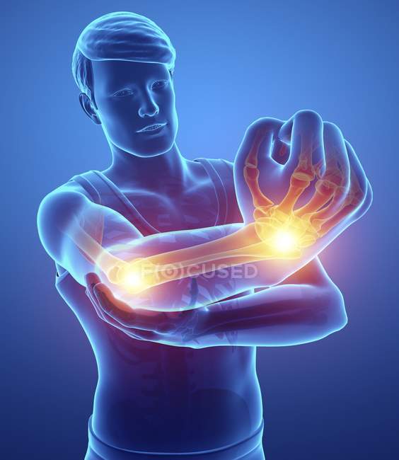 Silhueta masculina com dor no braço, ilustração digital . — Fotografia de Stock