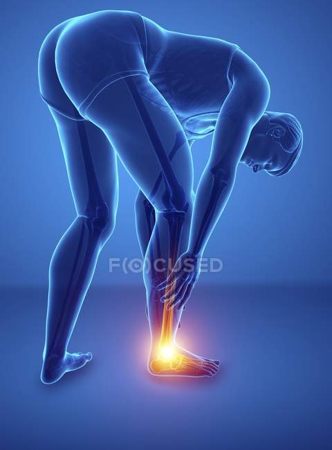 Pliage de la silhouette masculine avec douleur au pied, illustration numérique
. — Photo de stock