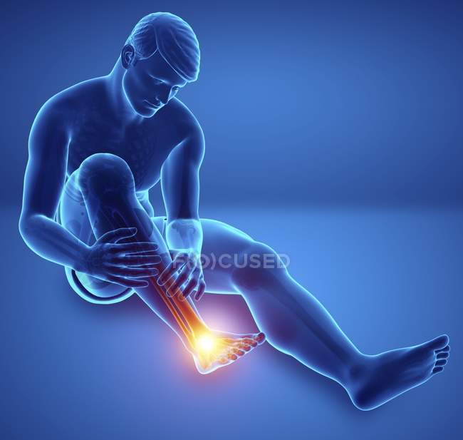 Sentado silueta masculina con dolor en el pie, ilustración digital . - foto de stock