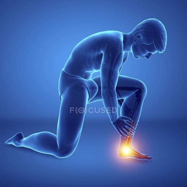 Flexión silueta masculina con dolor en el pie, ilustración digital . - foto de stock