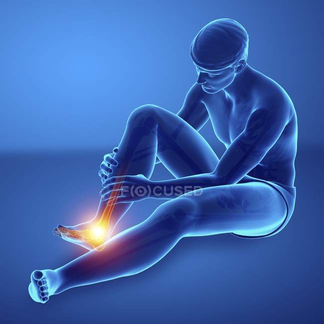 Sentado silueta masculina con dolor en el pie, ilustración digital . - foto de stock