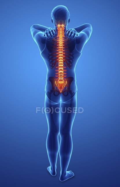 Чоловічий силует з болем у спині, цифрова ілюстрація . — стокове фото