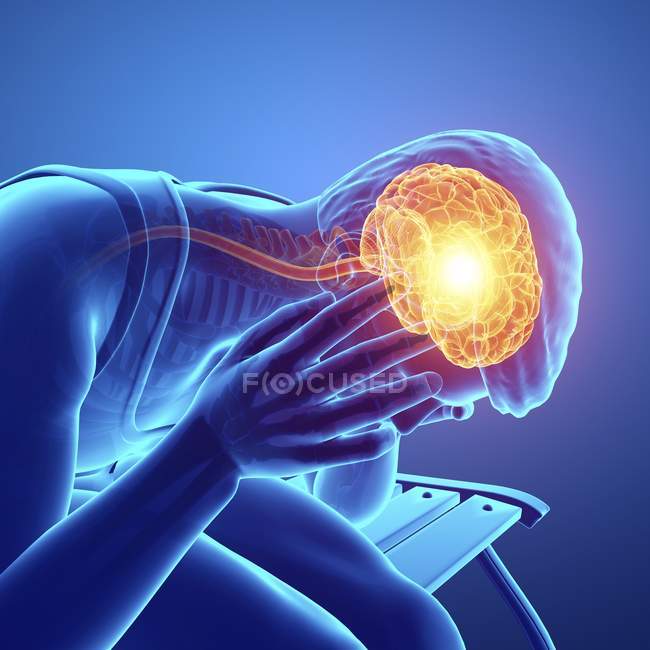 Männliche Silhouette mit Kopfschmerzen, digitale Illustration. — Stockfoto