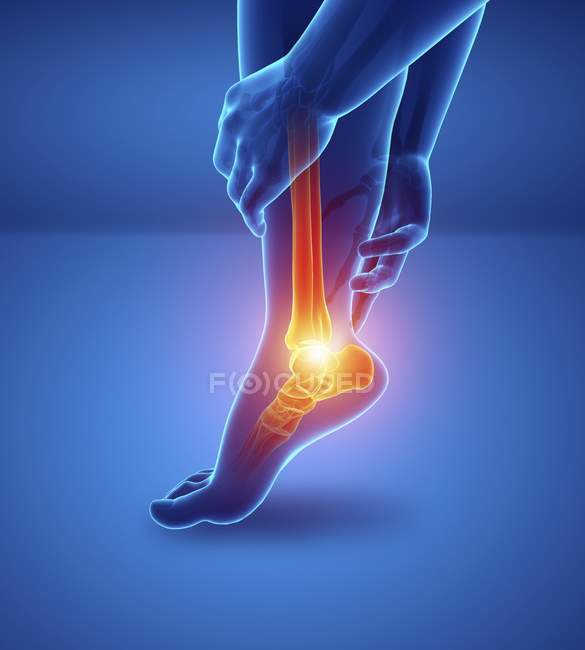 Männliche Fußsilhouette mit Fußschmerzen, digitale Illustration. — Stockfoto
