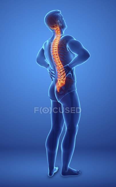 Männliche Silhouette mit Rückenschmerzen, digitale Illustration. — Stockfoto