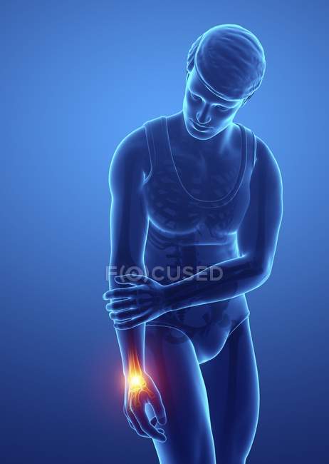 Männliche Silhouette mit Schmerzen am Handgelenk, digitale Illustration. — Stockfoto