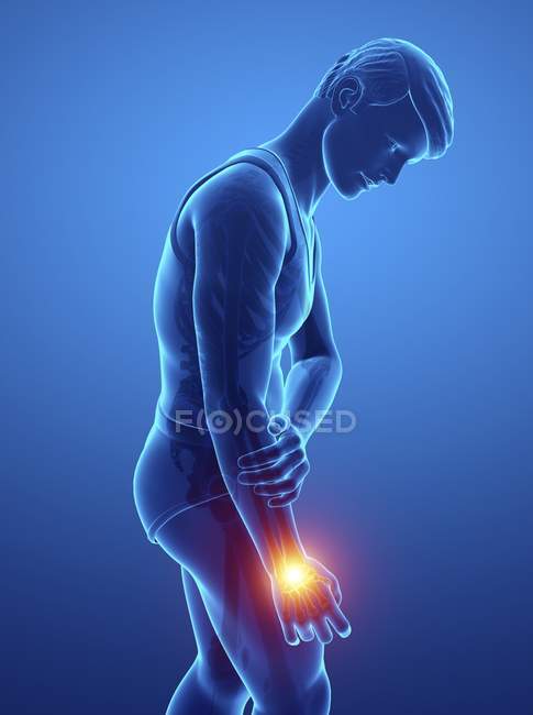 Male silhouette with wrist pain, digital illustration. — Stock Photo