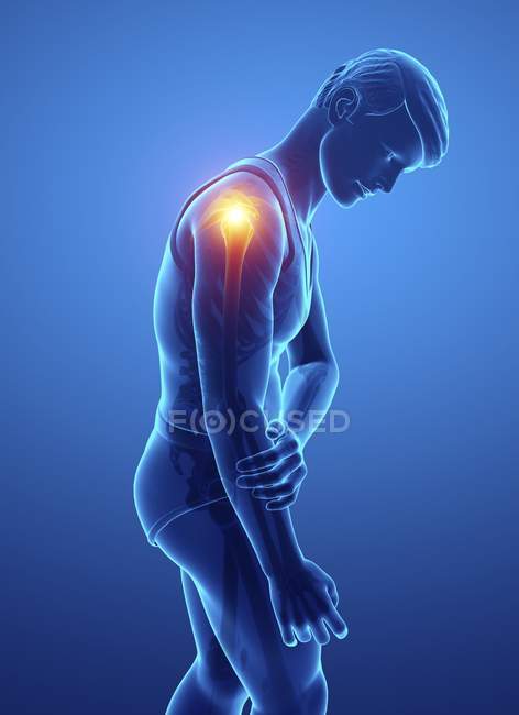 Silueta masculina con dolor de hombro, ilustración digital . - foto de stock