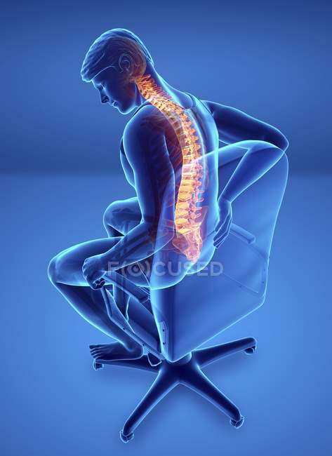 Sentado em cadeira silhueta masculina com dor nas costas, ilustração digital . — Fotografia de Stock