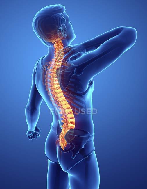 Silueta masculina con dolor de espalda, ilustración digital . - foto de stock