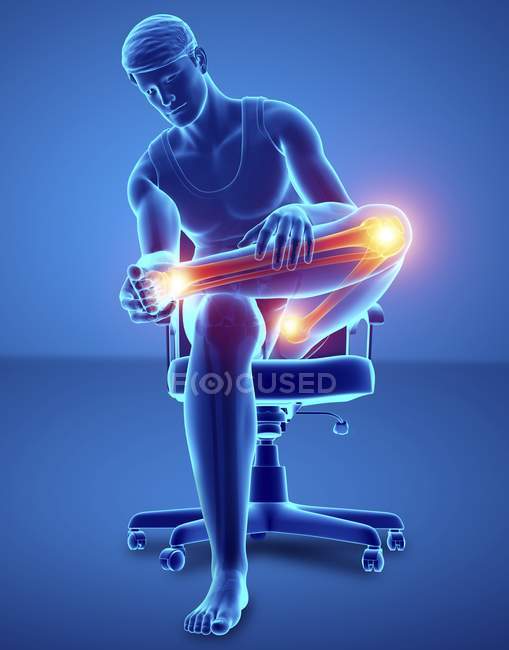 Sentado en silla silueta masculina con dolor de rodilla, ilustración digital . - foto de stock