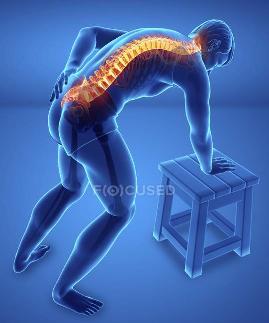 Apoyado en el taburete silueta masculina con dolor de espalda, ilustración digital . - foto de stock
