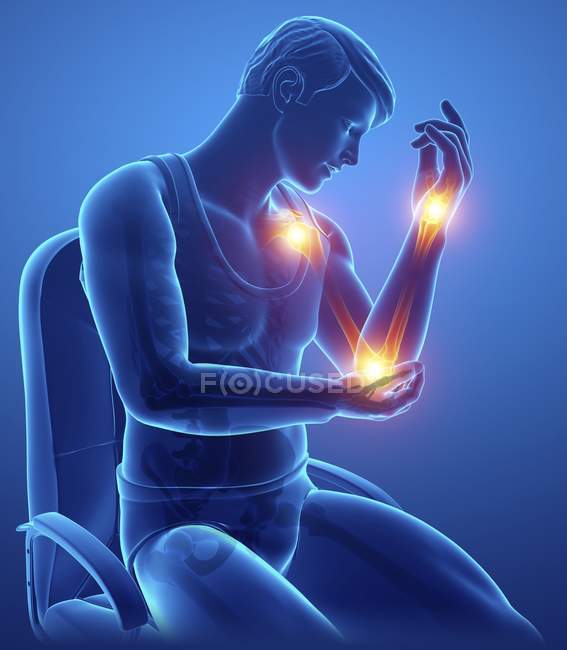 Seduto in sedia silhouette maschile con dolore al braccio, illustrazione digitale . — Foto stock